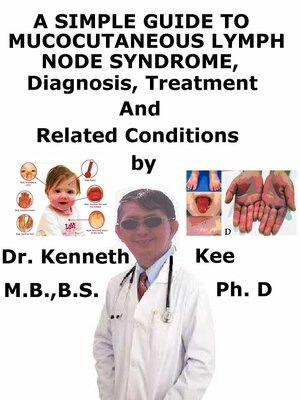 cover image of A Simple Guide to Mucocutaneous Lymph Node Syndrome (Kawasaki Disease), Diagnosis, Treatment and Related Conditions